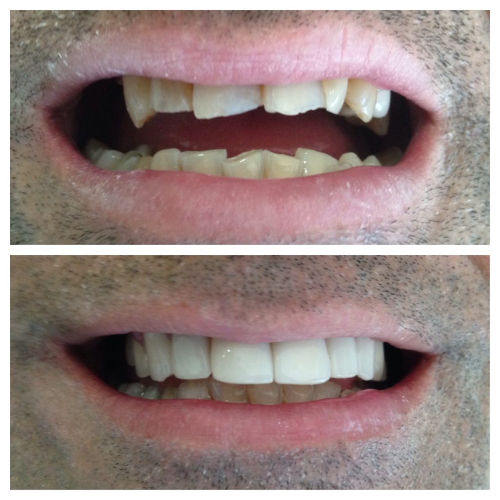 Results of our effective dental treatments