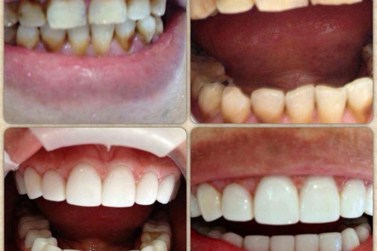 Results of our dental treatments