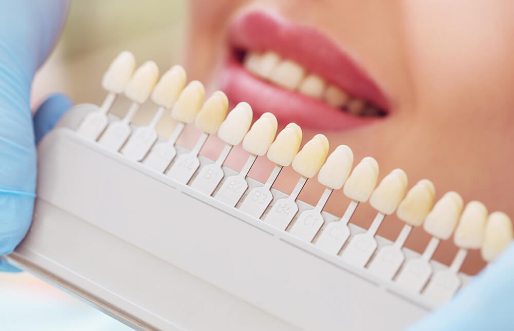 Port-Orange-Teeth-Whitening-Cosmetic-Dentistry